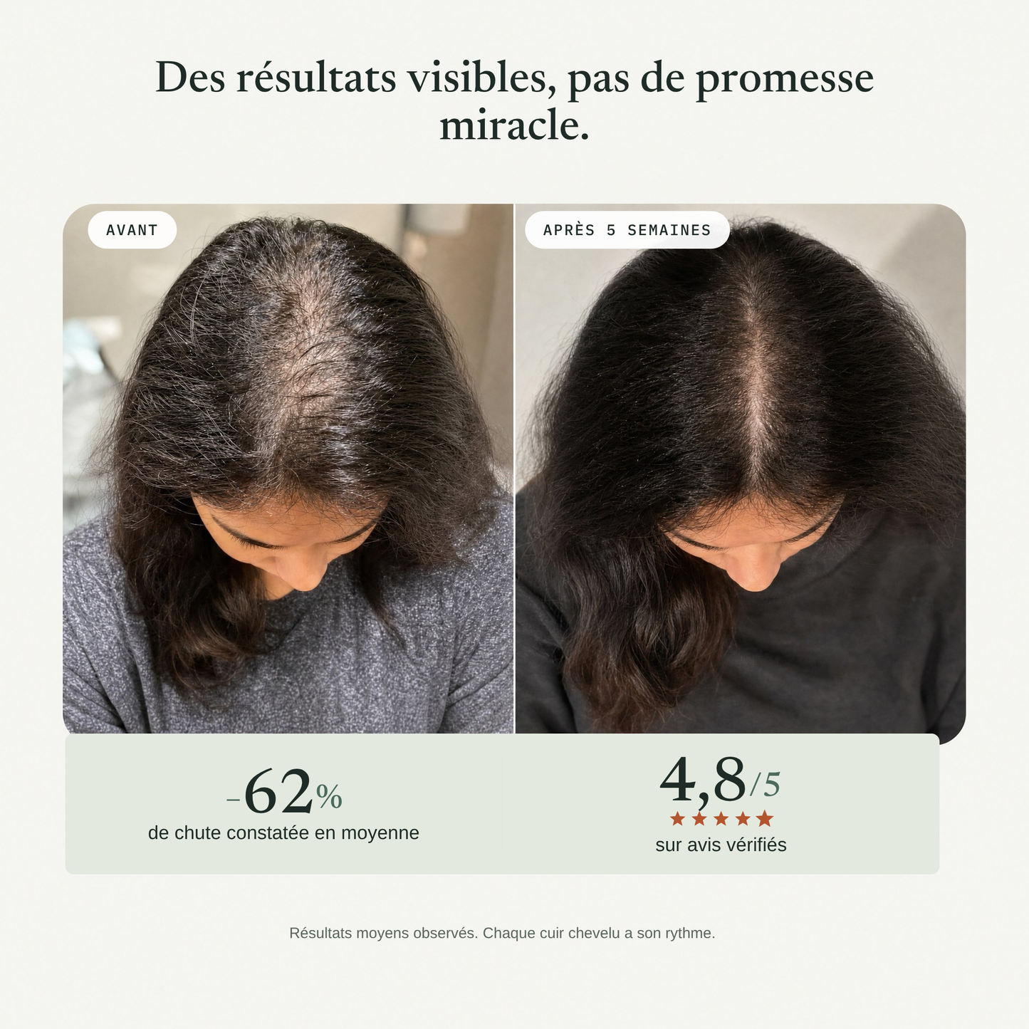La Barre Exfoliante du Cuir Chevelu
